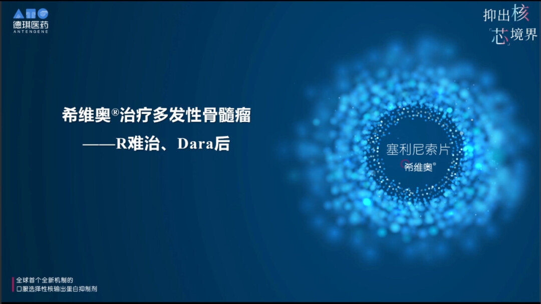 塞利尼索治疗多发性骨髓瘤