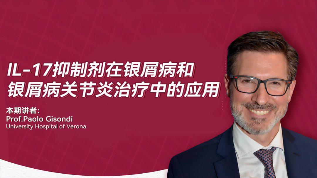 lL-17抑制剂在银屑病和银屑病关节炎治疗中的应用