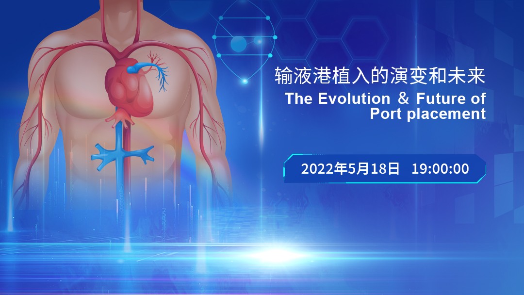 输液港植入的演变和未来