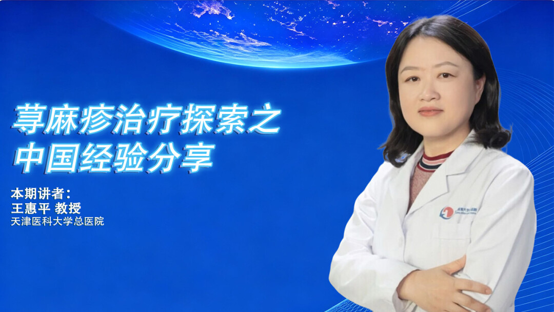 荨麻疹治疗探索之中国经验分享