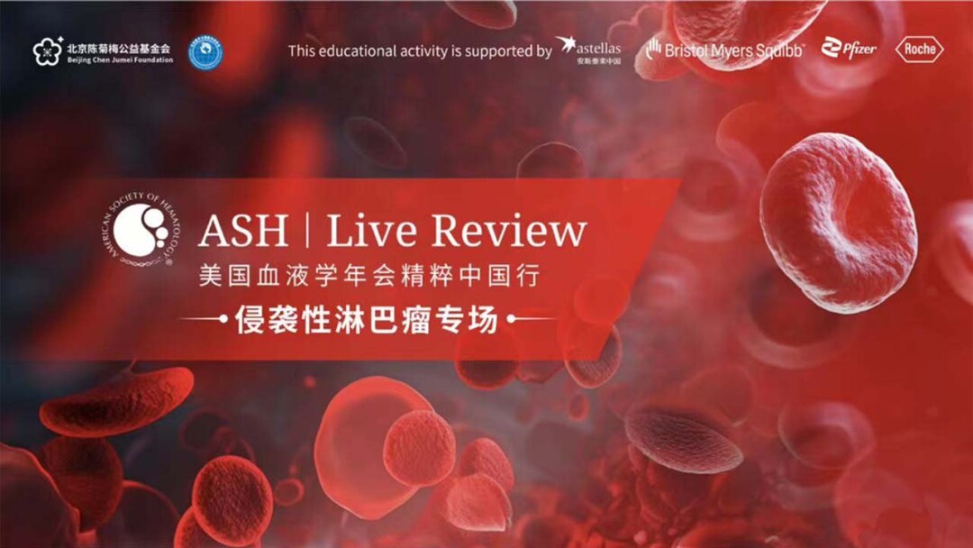 ASH | Live Review-美国血液学年会精粹中国行-侵袭性淋巴瘤专场