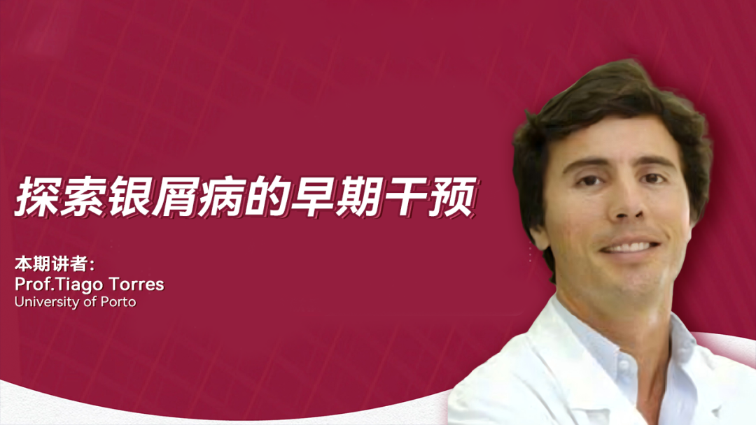 探索银屑病的早期干预
