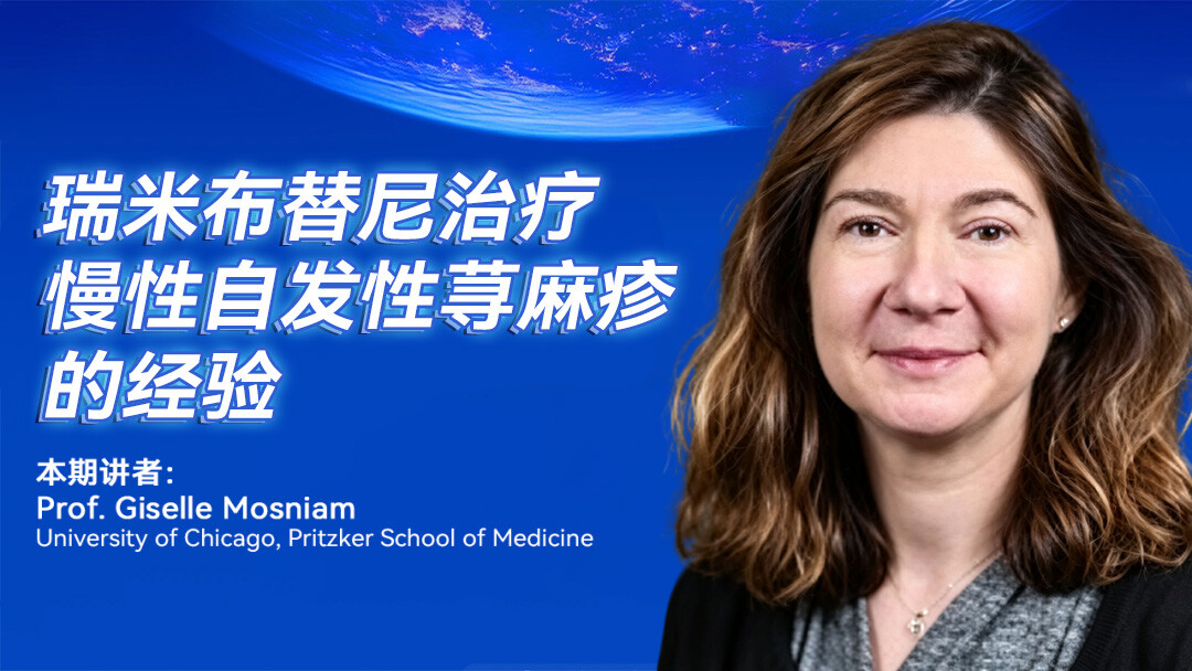 瑞米布替尼治疗慢性自发性荨麻疹的经验