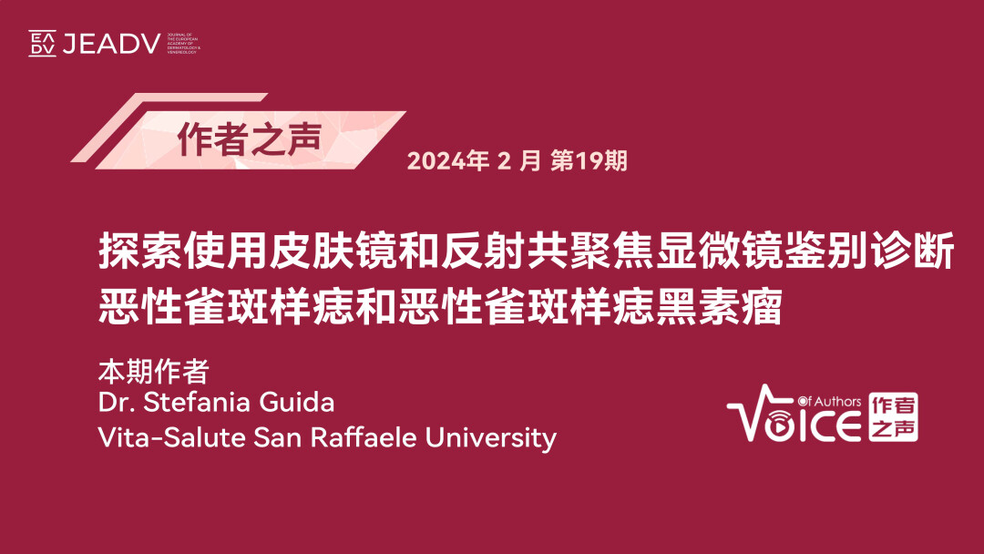 第19期 | 作者之声：探索使用皮肤镜和反射共聚焦显微镜鉴别诊断恶性雀斑样痣和恶性雀斑样痣黑素瘤